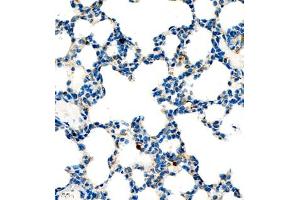 Immunohistochemistry of paraffin embedded mouse lung using P4H (ABIN7074215) at dilution of 1:700 (400x lens) (HIF Prolyl Hydroxylase anticorps)