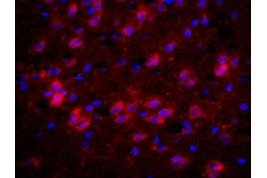 Formalin-fixed and paraffin-embedded rat brain labeled with Anti-CHRM4/mAChR M4 Polyclonal Antibody, Unconjugated (ABIN1387838) 1:200, overnight at 4°C, The secondary antibody was Goat Anti-Rabbit IgG, PE conjugated used at 1:200 dilution for 40 minutes at 37°C. (CHRM4 anticorps  (AA 1-31))