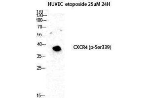 Western Blotting (WB) image for anti-Chemokine (C-X-C Motif) Receptor 4 (CXCR4) (pSer339) antibody (ABIN3179770) (CXCR4 anticorps  (pSer339))