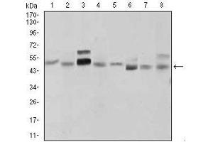 Western blot analysis using SHH mouse mAb against LNCaP (1), HepG2 (2), PANC-1 (3),HeLa (4), SK-N-SH (5), F9 (6), NIH3T3 (7), and COS7 (8) cell lysate. (Sonic Hedgehog anticorps  (AA 26-161))