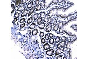 IHC testing of FFPE rat small intestine tissue with CBX3 antibody at 1ug/ml. (CBX3 anticorps)