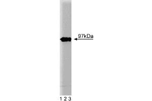 Western blot analysis of Eps8 on a lysate from mouse macrophages (RAW 264. (EPS8 anticorps  (AA 628-821))