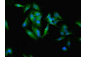 Immunofluorescent analysis of Hela cells using ABIN7171000 at dilution of 1:100 and Alexa Fluor 488-congugated AffiniPure Goat Anti-Rabbit IgG(H+L) (SOCS3 anticorps  (AA 1-224))