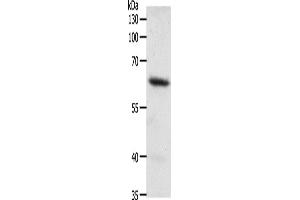 Western Blotting (WB) image for anti-Frizzled Family Receptor 4 (FZD4) antibody (ABIN2428931) (FZD4 anticorps)
