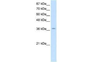 WB Suggested Anti-ZNF550 Antibody Titration:  2. (ZNF550 anticorps  (Middle Region))