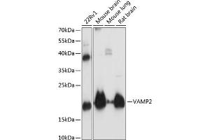 Western blot analysis of extracts of various cell lines, using V antibody (ABIN3021846, ABIN3021847, ABIN1513674 and ABIN6216136) at 1:3000 dilution. (VAMP2 anticorps  (AA 1-100))