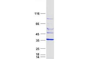 Validation with Western Blot