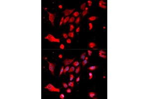 Immunofluorescence analysis of U20S cell using MAD2L1 antibody. (MAD2L1 anticorps)
