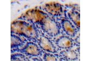 Used in DAB staining on fromalin fixed paraffin-embedded Intestine tissue