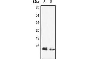 Western blot analysis of FABP5 expression in mouse skin (A), mouse thymus (B) whole cell lysates. (FABP5 anticorps)