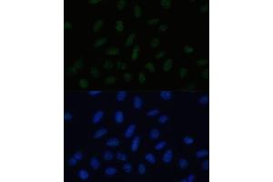 anti-Proline-, Glutamic Acid- and Leucine-Rich Protein 1 (PELP1) (AA 1021-1180) antibody