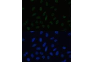 Immunofluorescence analysis of U-2 OS cells using PELP1 Polyclonal Antibody (ABIN3023501, ABIN3023502, ABIN3023503 and ABIN6220149) at dilution of 1:100 (40x lens). (PELP1 anticorps  (AA 1021-1180))