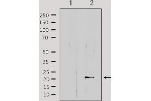 Western blot analysis of extracts from HepG2, using MRPL32 Antibody. (MRPL32 anticorps  (Internal Region))