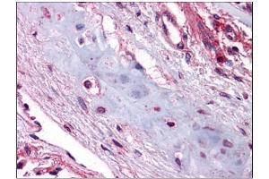 Human Lung, Chondrocytes: Formalin-Fixed, Paraffin-Embedded (FFPE) (UCMA anticorps  (C-Term))
