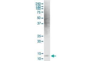 HBXIP monoclonal antibody (M12), clone 4G1. (HBXIP anticorps  (AA 83-173))