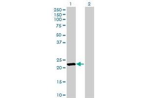 Lane 1: SFTPC transfected lysate ( 21. (SFTPC 293T Cell Transient Overexpression Lysate(Denatured))