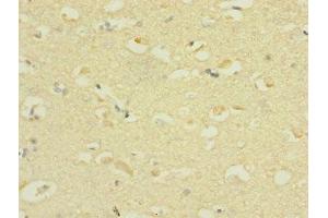 Immunohistochemistry of paraffin-embedded human brain tissue using ABIN7169924 at dilution of 1:100 (SCN3A anticorps  (AA 274-400))