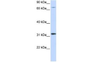 WB Suggested Anti-ZNF799 Antibody Titration:  0. (ZNF799 anticorps  (Middle Region))