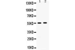 Western blot analysis of ALDH3A2 expression in rat liver extract ( Lane 1) and 22RV1 whole cell lysates ( Lane 2).