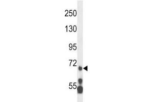 MLL5 antibody western blot analysis in HL-60 lysate. (MLL5/KMT2E anticorps  (AA 93-120))