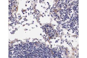 ABIN6267676 at 1/100 staining human lymph node tissue sections by IHC-P.
