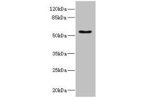 Western blot All lanes: CALCRantibody IgG at 5. (Calcitonin Receptor anticorps  (AA 25-148))
