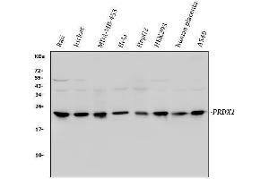 Western blot analysis of Peroxiredoxin 1 using anti-Peroxiredoxin 1 antibody (ABIN3043903). (Peroxiredoxin 1 anticorps  (Middle Region))
