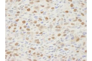 Immunohistochemistry (IHC) image for anti-Mismatch Repair Protein 2 (MSH2) (C-Term) antibody (ABIN7448673) (MSH2 anticorps  (C-Term))