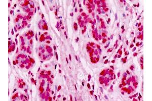 Anti-UBE2D1 / UBCH5 antibody IHC staining of human breast, epithelium.