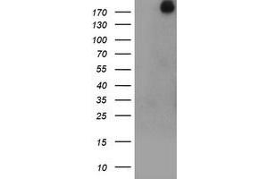 anti-Ubiquitin Specific Peptidase 9, X-Linked (USP9X) (AA 2246-2570) antibody