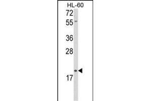 Western blot analysis of DLK2 Antibody (C-term) (ABIN652972 and ABIN2842616) in HL-60 cell line lysates (35 μg/lane). (DLK2 anticorps  (C-Term))