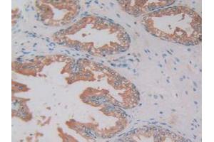 IHC-P analysis of Human Prostate Gland Tissue, with DAB staining. (Kallikrein 2 anticorps  (AA 19-261))