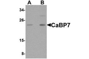 Western blot analysis of CaBP7 in Hela cell lysate with CaBP7 antibody at (A) 1 and (B) 2 μg/ml. (CABP7 anticorps  (N-Term))