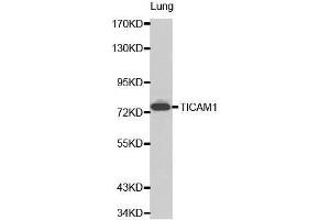 Western Blotting (WB) image for anti-Toll-Like Receptor Adaptor Molecule 1 (TICAM1) (AA 20-200) antibody (ABIN3021572) (TICAM1 anticorps  (AA 20-200))