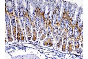 IHC analysis of Periostin using anti-Periostin antibody .
