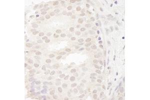 Immunohistochemistry (IHC) image for anti-Cancer Susceptibility Candidate 5 (CASC5) (AA 300-350) antibody (ABIN7448458) (CASC5 anticorps  (AA 300-350))
