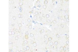 Immunohistochemistry of paraffin-embedded Rat brain using EIF3J Polyclonal Antibody at dilution of 1:100 (40x lens). (EIF3S1 anticorps)