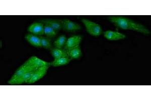 anti-Ribosomal Protein S4, Y-Linked 1 (RPS4Y1) (AA 197-263), (Isoform 1) antibody