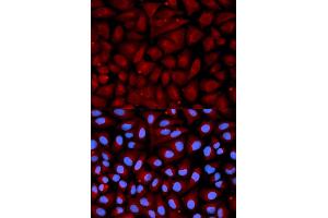 Immunofluorescence analysis of U2OS cells using SERPINC1 antibody. (SERPINC1 anticorps)