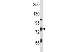TP63 antibody western blot analysis in MDA-MB231 lysate.