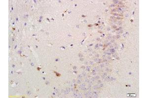 Formalin-fixed and paraffin-embedded mouse brain labeled with Rabbit Anti-Versican Polyclonal Antibody, Unconjugated 1:200 followed by conjugation to the secondary antibody and DAB staining