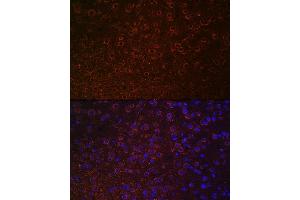 Immunofluorescence analysis of mouse brain using Dopamine Transporter/SLC6 Rabbit pAb (ABIN7270474) at dilution of 1:100 (40x lens).