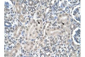 SHMT2 antibody was used for immunohistochemistry at a concentration of 4-8 ug/ml to stain Epithelial cells of renal tubule (arrows) in Human Kidney. (SHMT2 anticorps)
