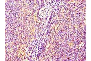 Immunohistochemistry of paraffin-embedded human lymph node tissue using ABIN7175013 at dilution of 1:100 (C17orf58 anticorps  (AA 21-90))