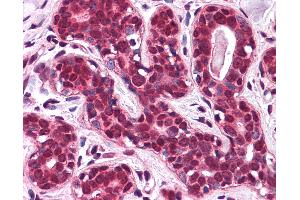 Anti-SLC5A6 antibody IHC of human breast. (SLC5A6 anticorps  (N-Term))