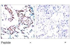 Image no. 1 for anti-Jun Proto-Oncogene (JUN) (Tyr170) antibody (ABIN197132) (C-JUN anticorps  (Tyr170))