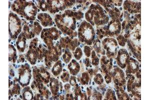 Image no. 7 for anti-Proteasome Subunit alpha 6 (PSMA6) antibody (ABIN1500464)