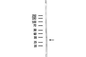 anti-Calcium Binding Protein 4 (CABP4) (Internal Region) antibody