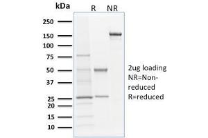 SDS-PAGE Analysis Purified Langerin Mouse Monoclonal Antibody (LGRN/1821). (CD207 anticorps  (AA 74-213))