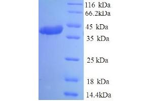 SDS-PAGE (SDS) image for Coronavirus OC43 Spike Protein (HCoV-OC43 S) (AA 15-344), (partial) protein (His tag) (ABIN5714100)